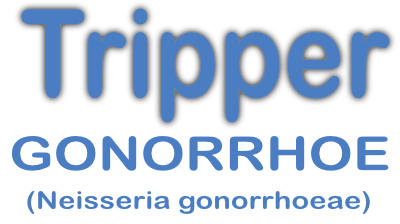 Tripper